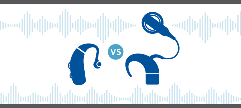 Hearing Aids vs. Cochlear Implants