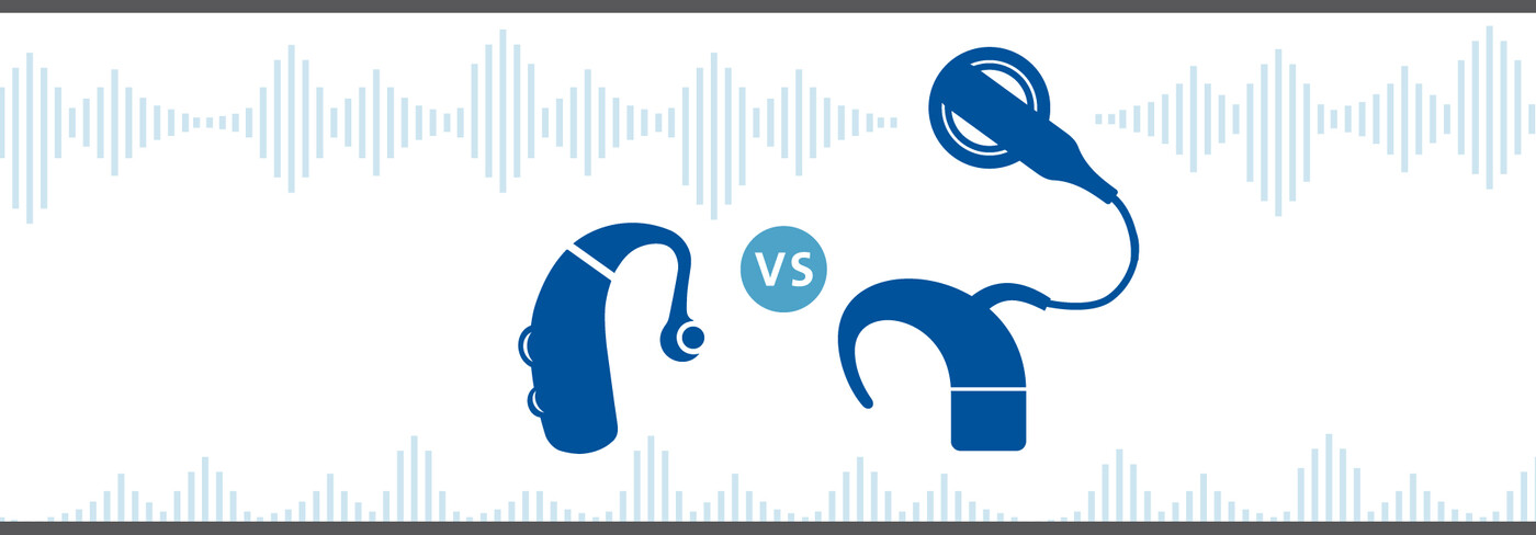 Hearing Ads vs Cochlear Implants